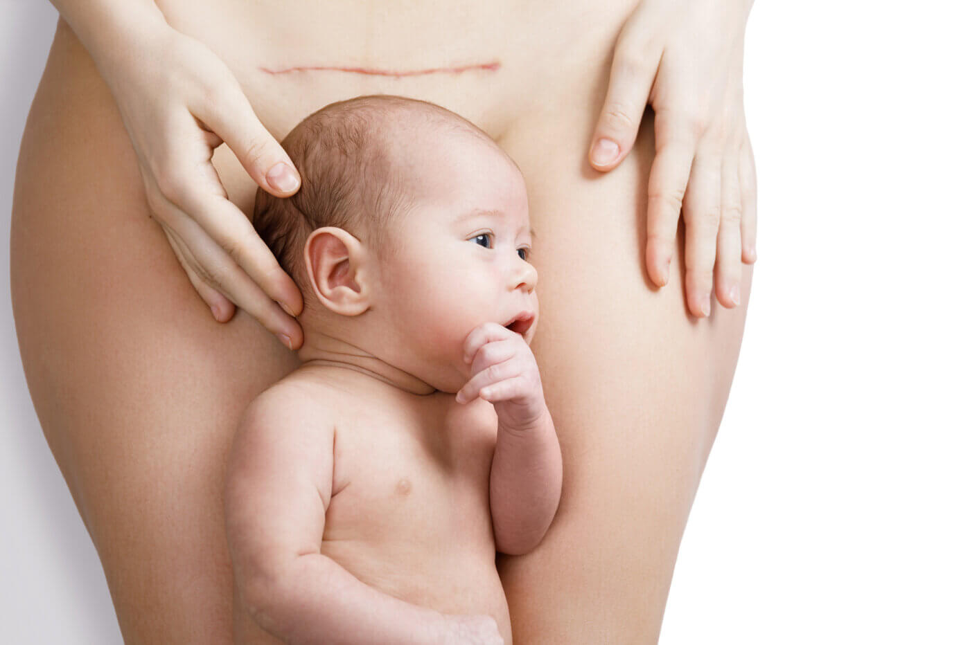 Things to Know about C-section